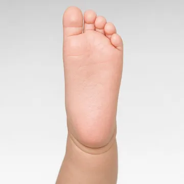 AI-generated baby foot, plantar view, showing medial crease